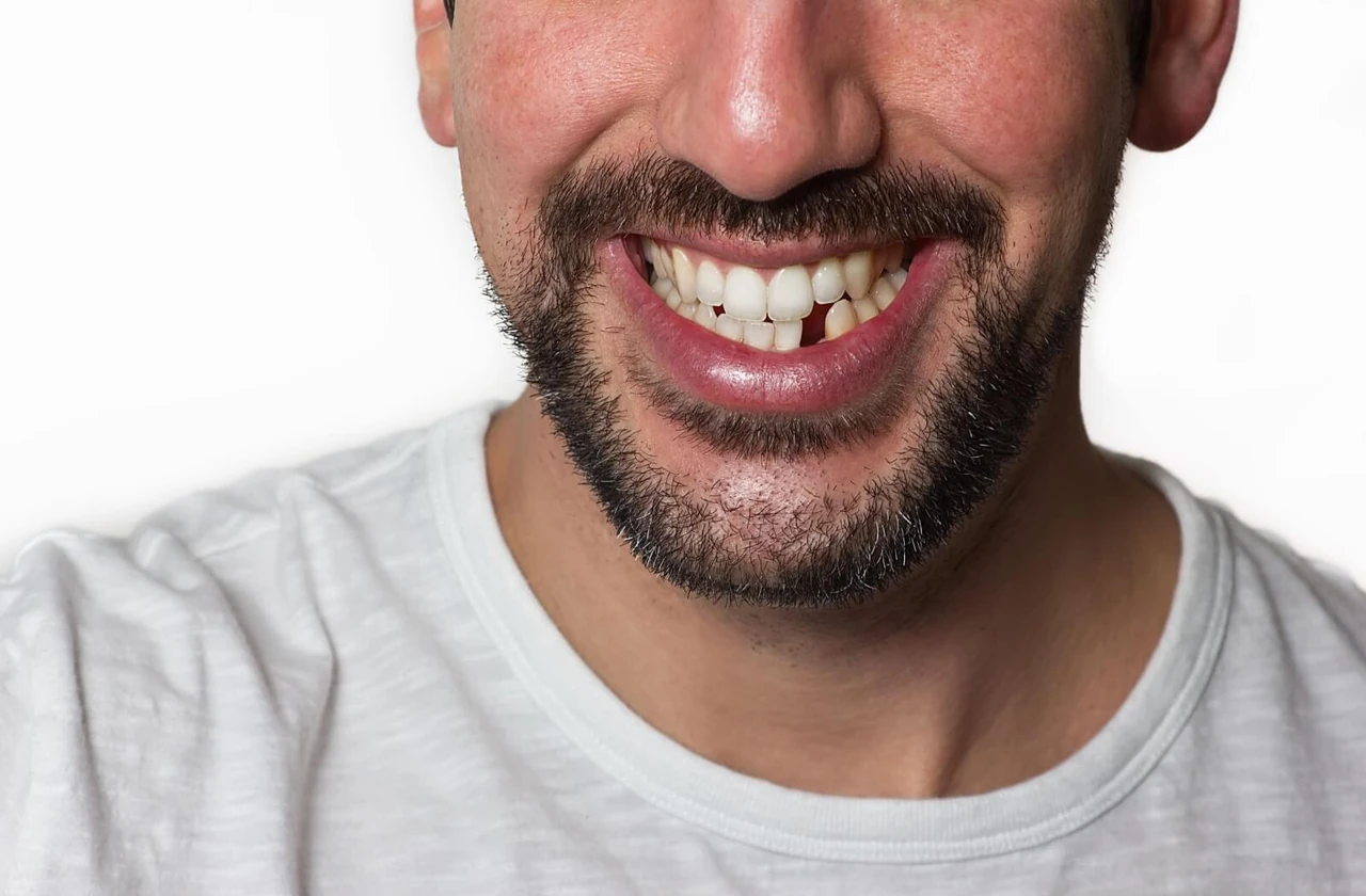 Close-up of an adult smiling with a missing tooth near the front; eyes are not visible.