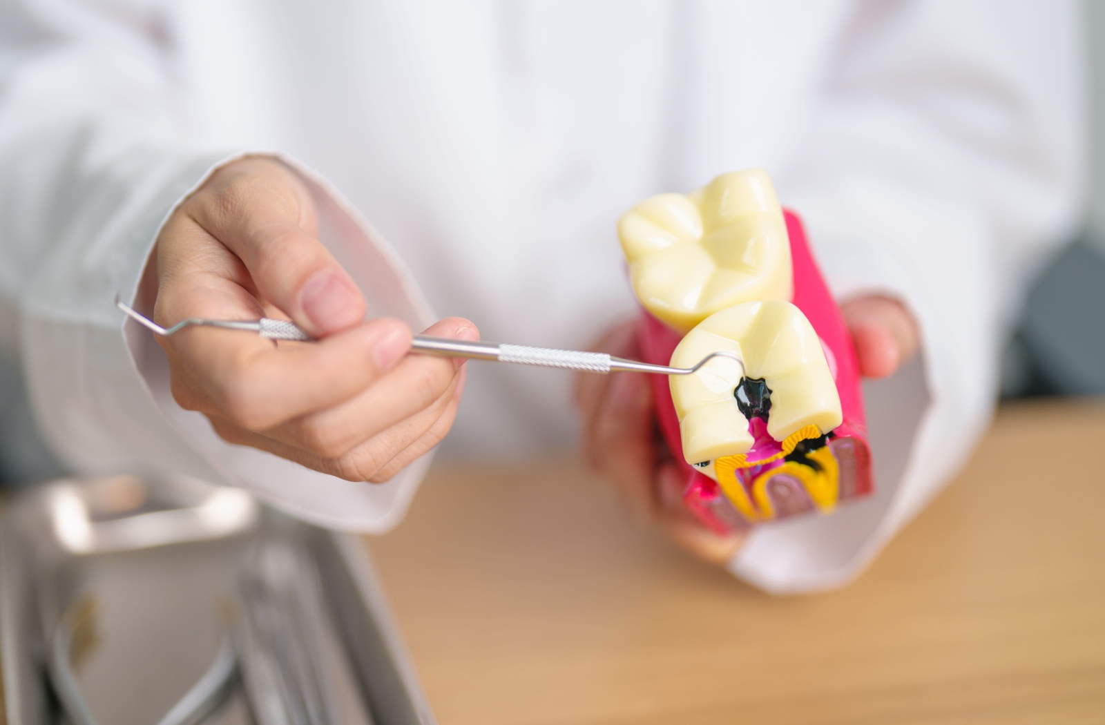 A dentist holding an anatomy model of a decaying tooth while pointing at the cavity with dental tool.