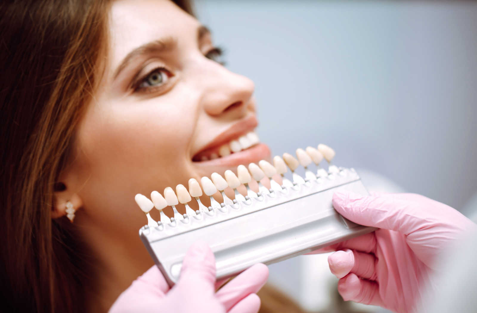 How Long Do Veneers Last? | Kensington Dental Care