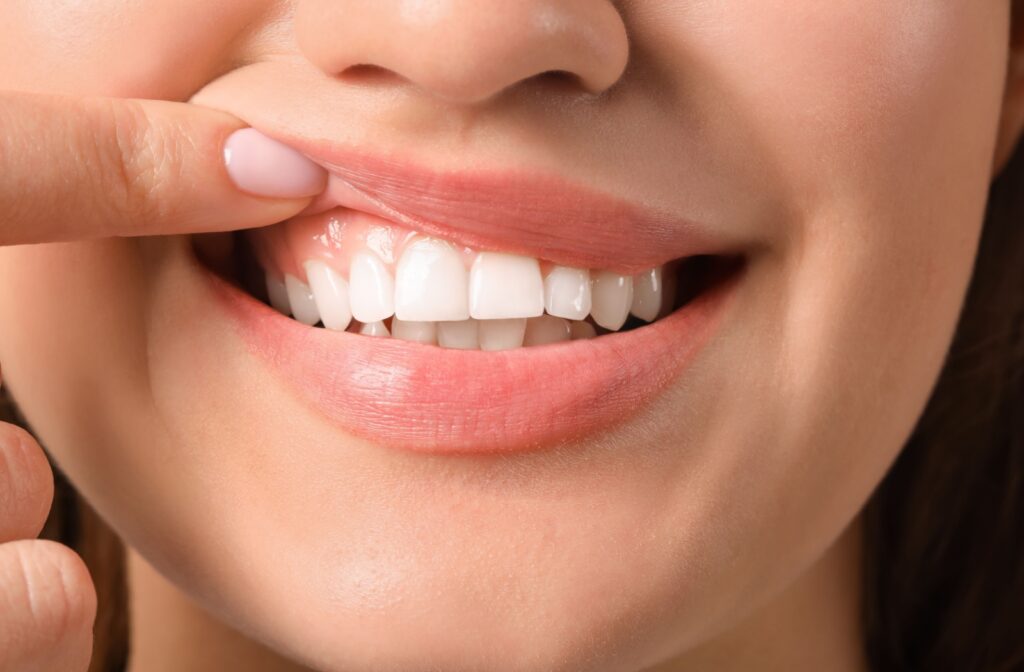 Patient pointing to healthy gums and tooth enamel.